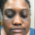 Miwani dark under eyes