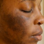 Tu as la peau abîmée, irrégulière, avec des taches…