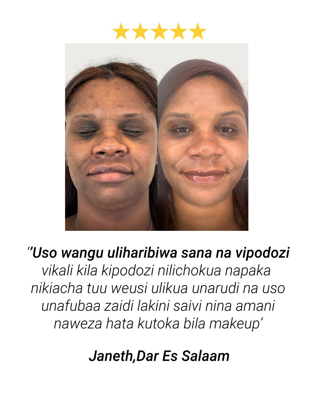 Matokeo ya mteja wa Amino Acid Cleanser