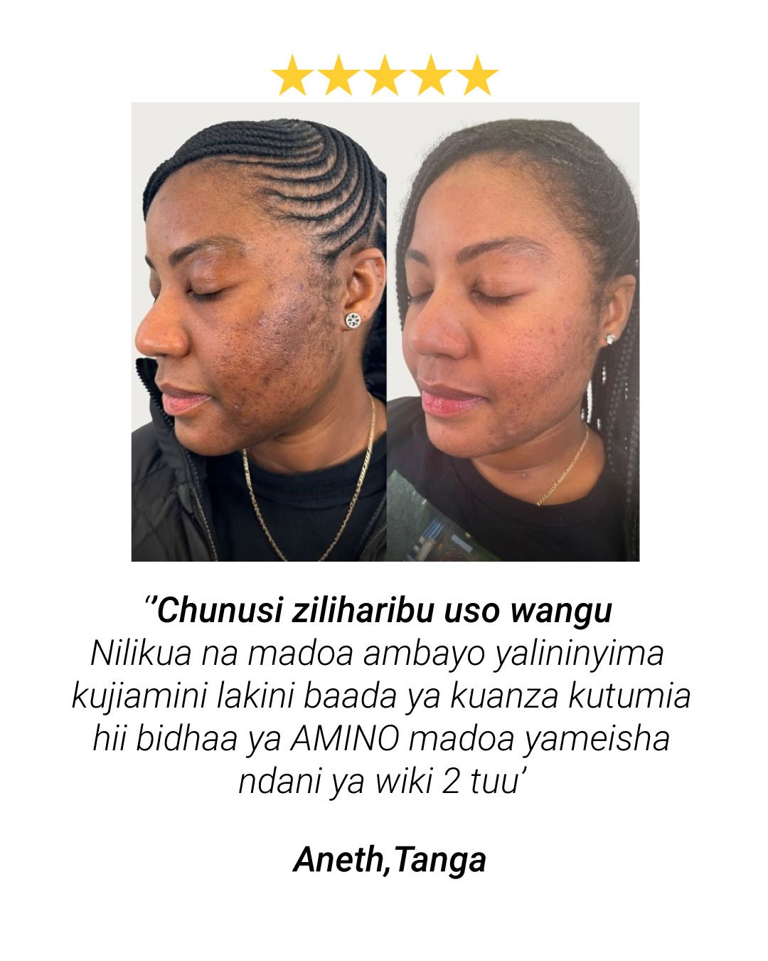 Matokeo ya mteja wa Amino Acid Cleanser