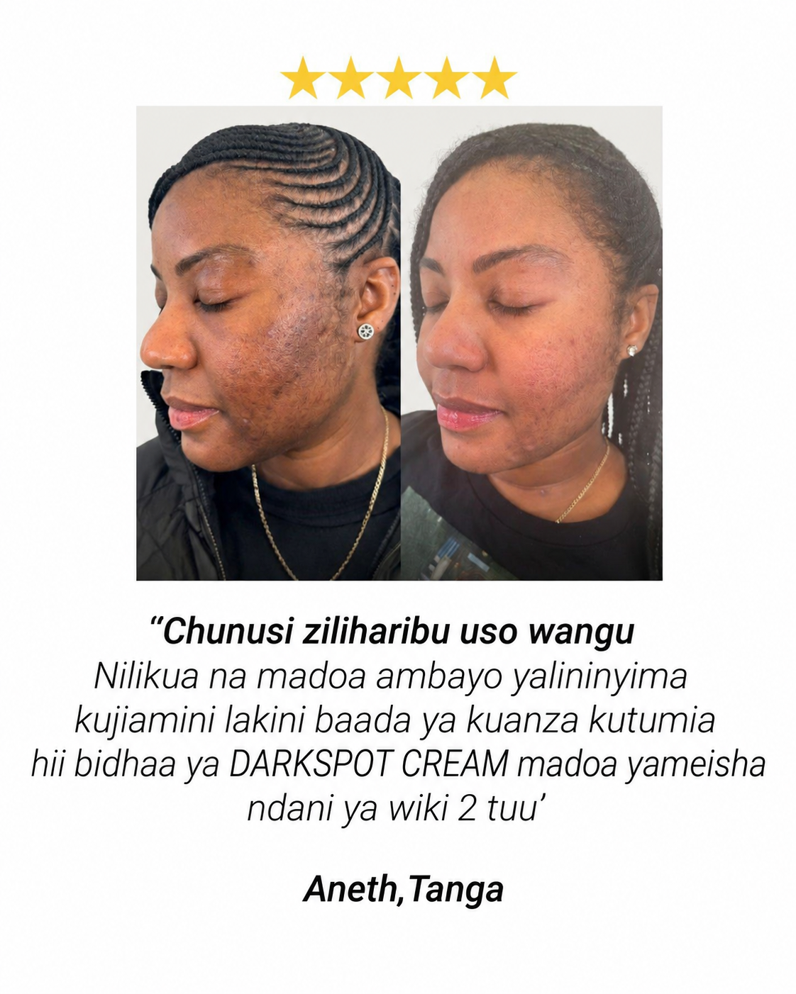 Maoni ya mteja wa Darkspot Cream