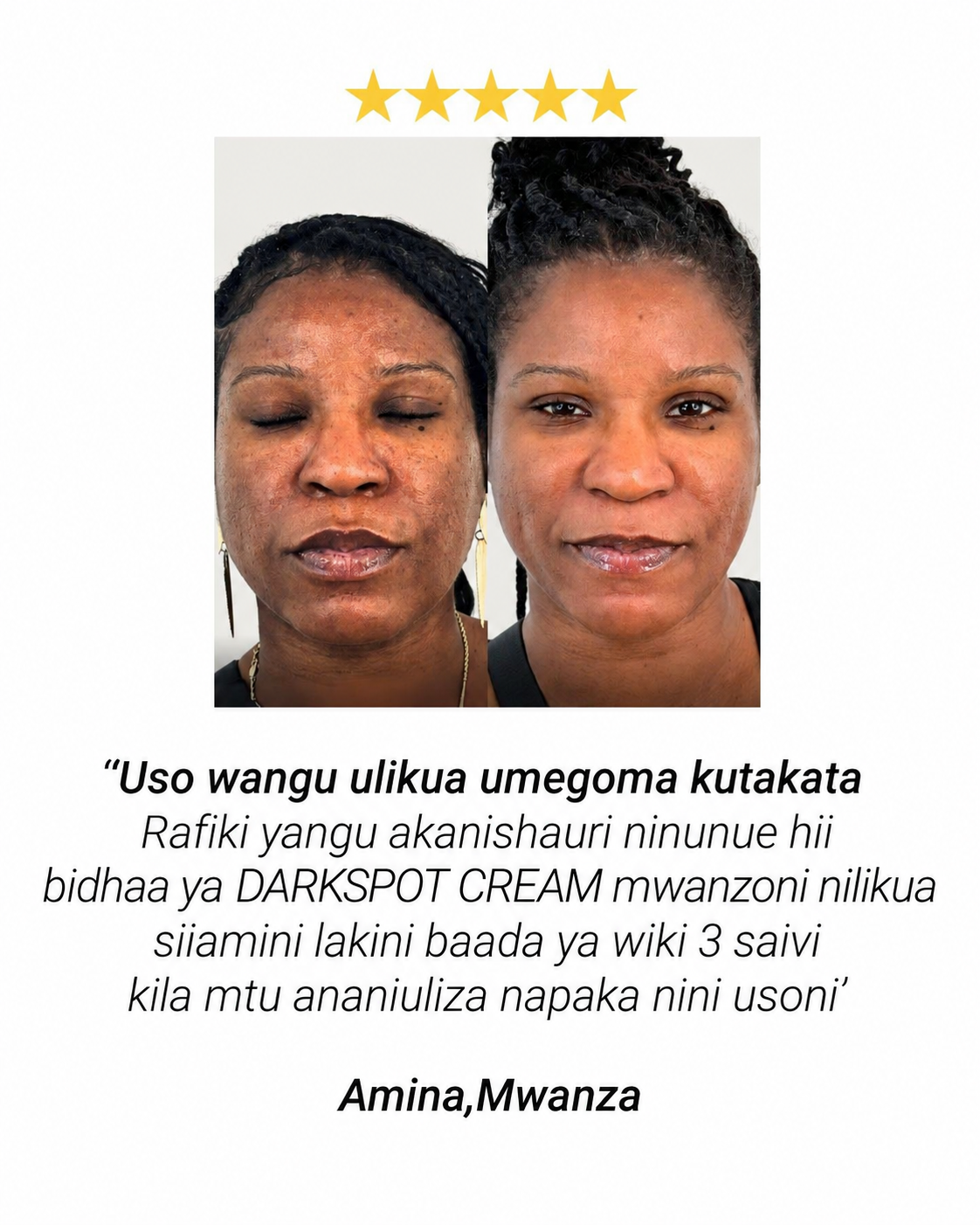 Maoni ya mteja kuhusu Darkspot Cream