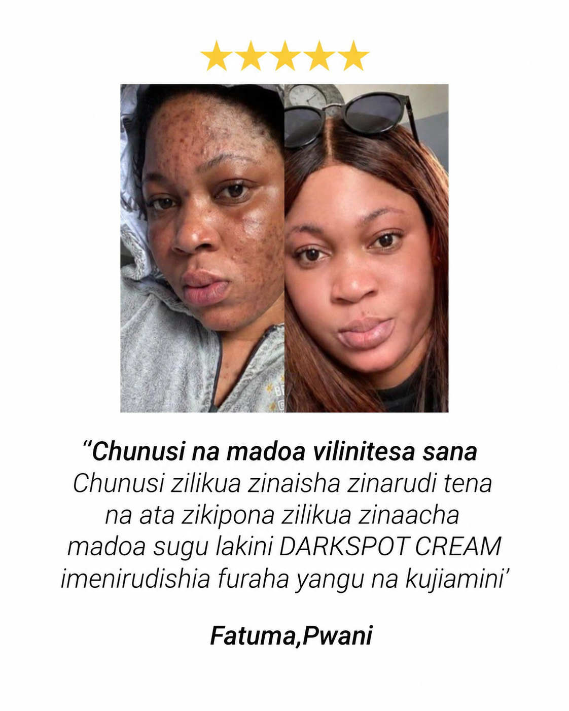 Maoni ya mteja mwingine aliyetumia Darkspot Cream
