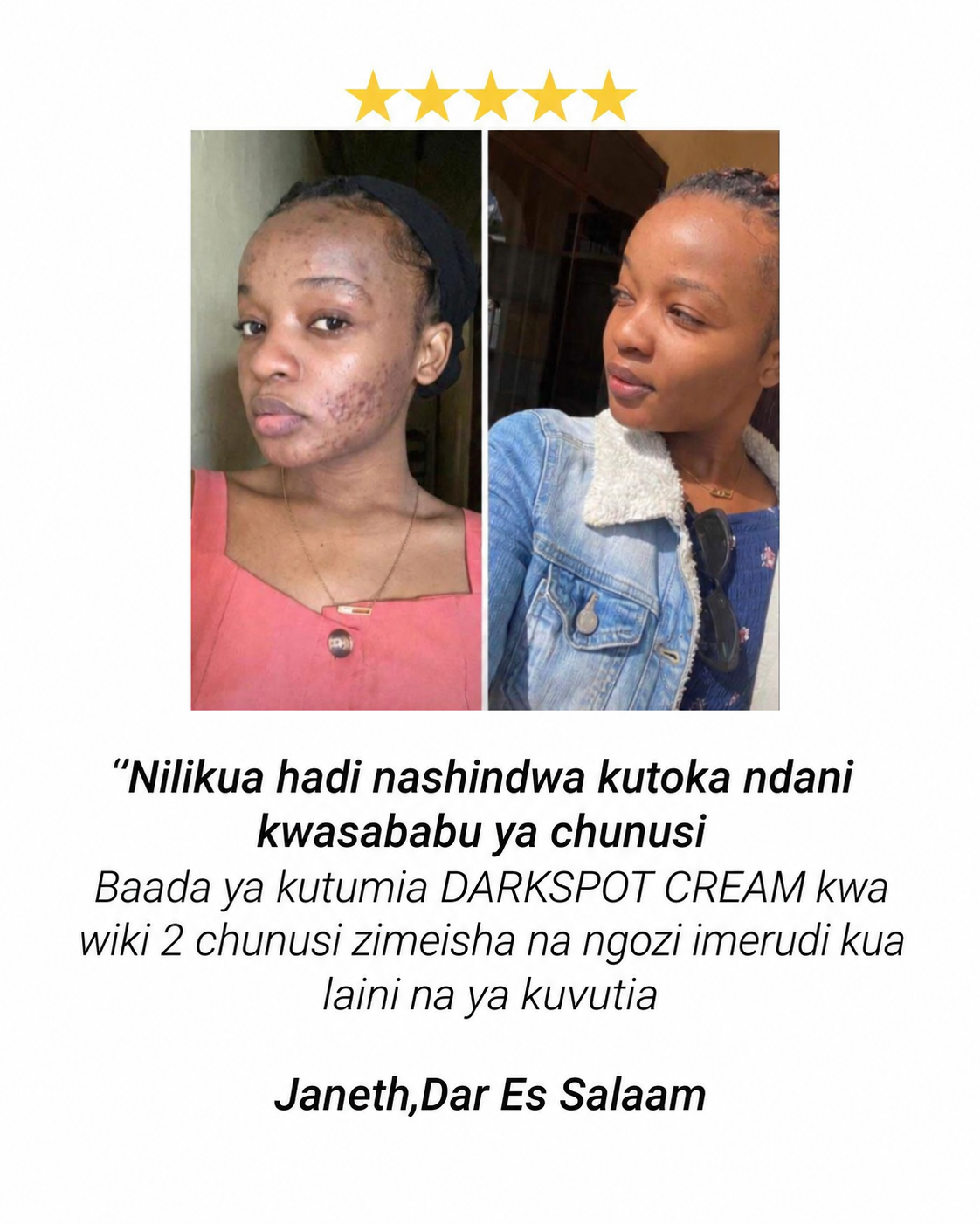 Ushuhuda wa mteja aliyetumia Darkspot Cream