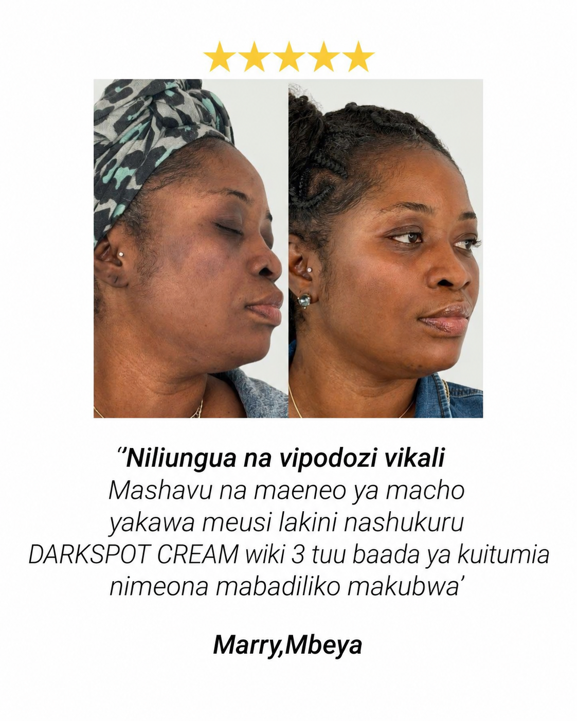 Maoni ya mteja aliyetumia Darkspot Cream