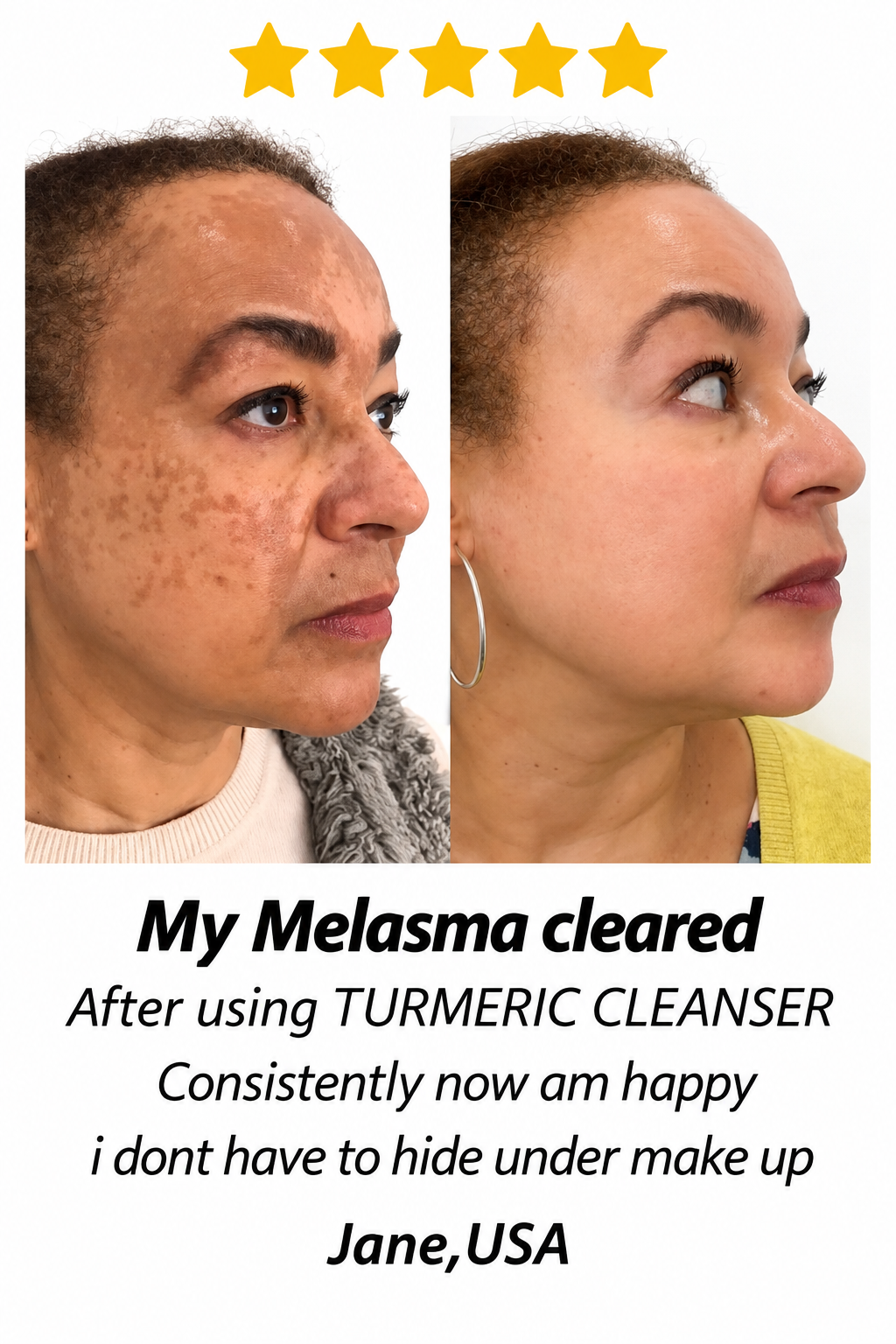 Mteja akieleza uzoefu wake baada ya kutumia Turmeric Refreshing Facial Cleanser