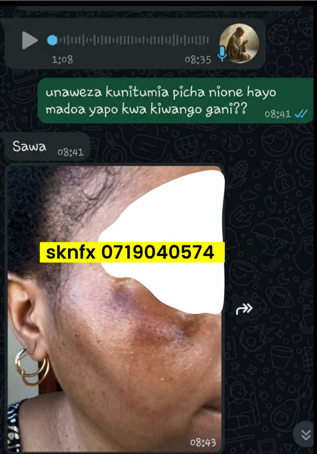 Sehemu ya pili ya story ya mteja wa SKNFX