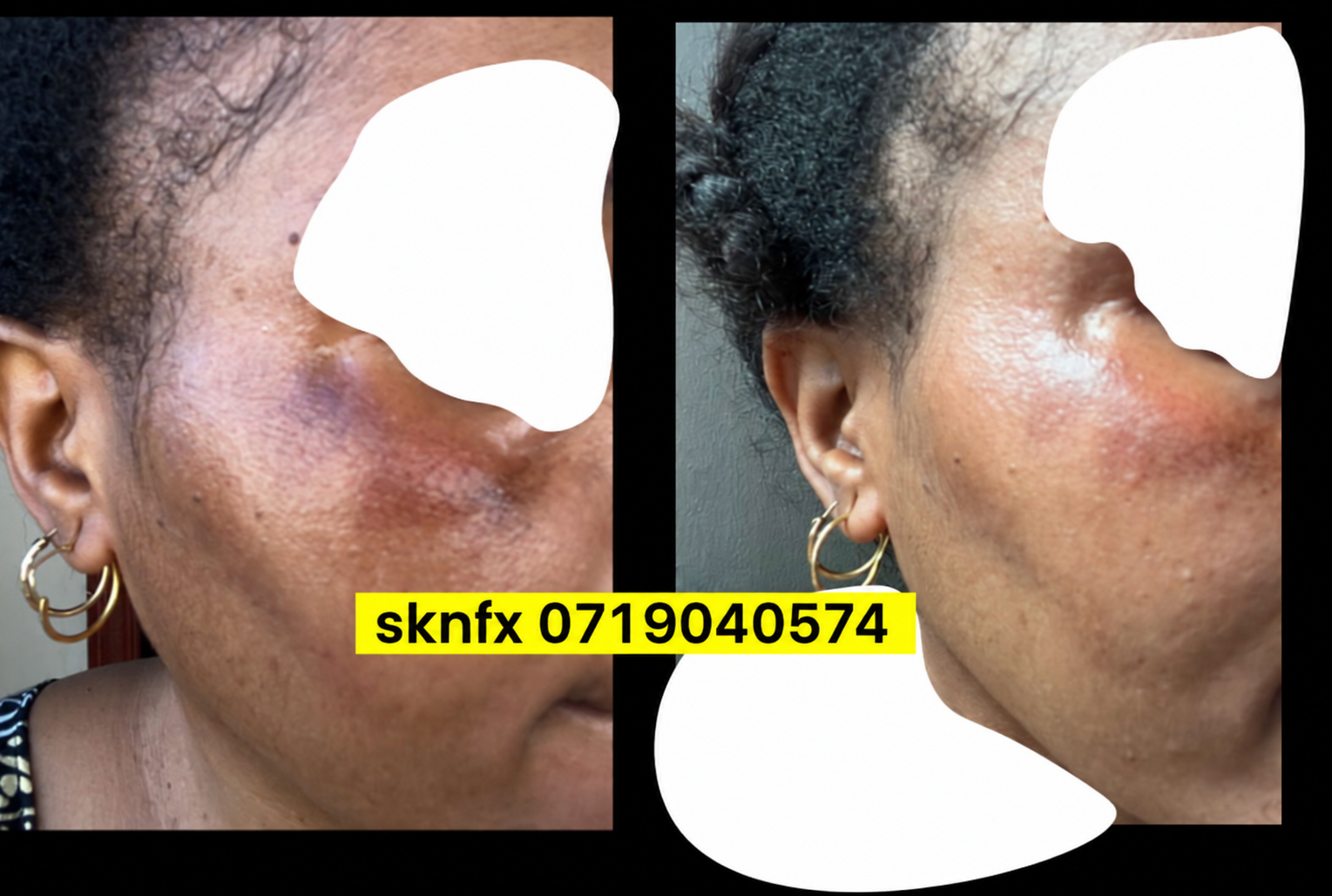Sehemu ya tatu ya story ya mteja wa SKNFX