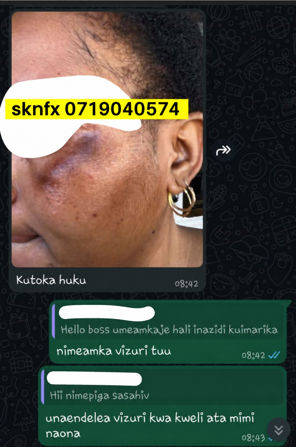 Sehemu ya kumi ya story ya mteja wa SKNFX