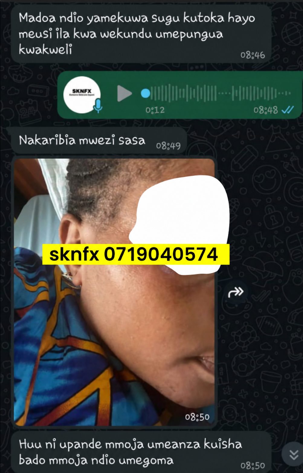 Sehemu ya saba ya story ya mteja wa SKNFX