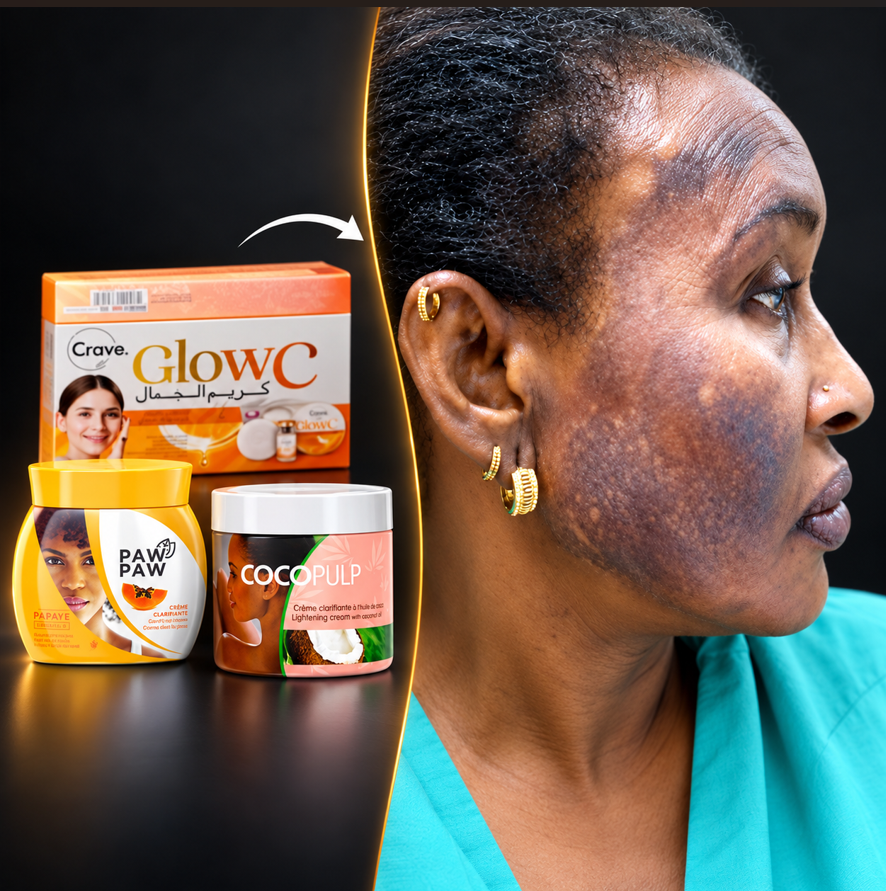 Mfano wa facecream za bei nafuu na ngozi iliyoharibika