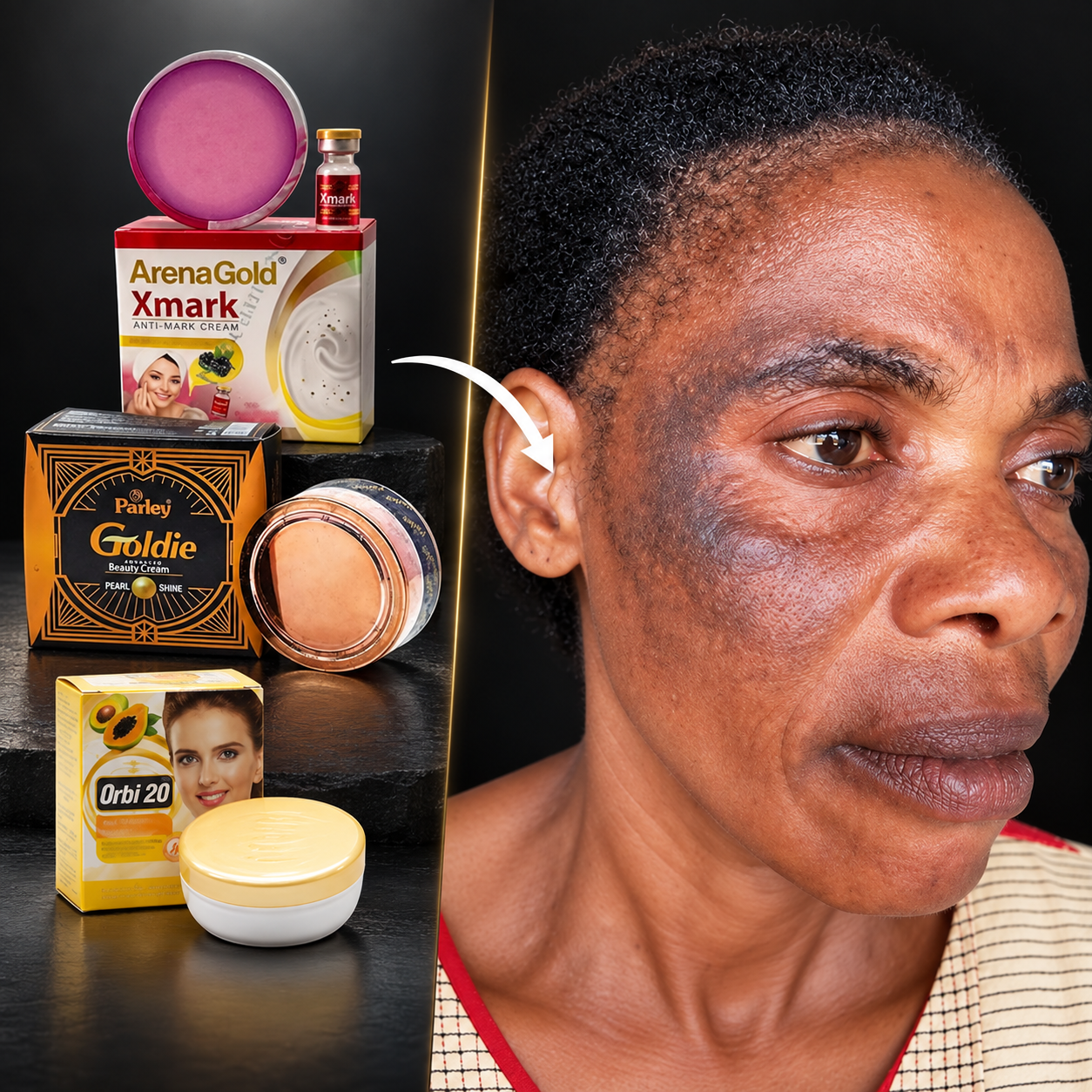Facecream mbalimbali pamoja na mfano wa ngozi iliyoharibika
