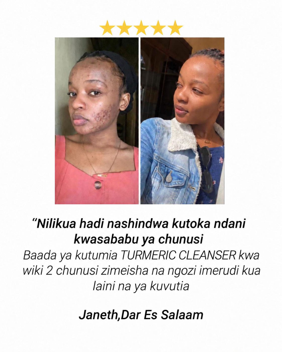 Maoni ya mteja aliyetumia Turmeric Refreshing Facial Cleanser