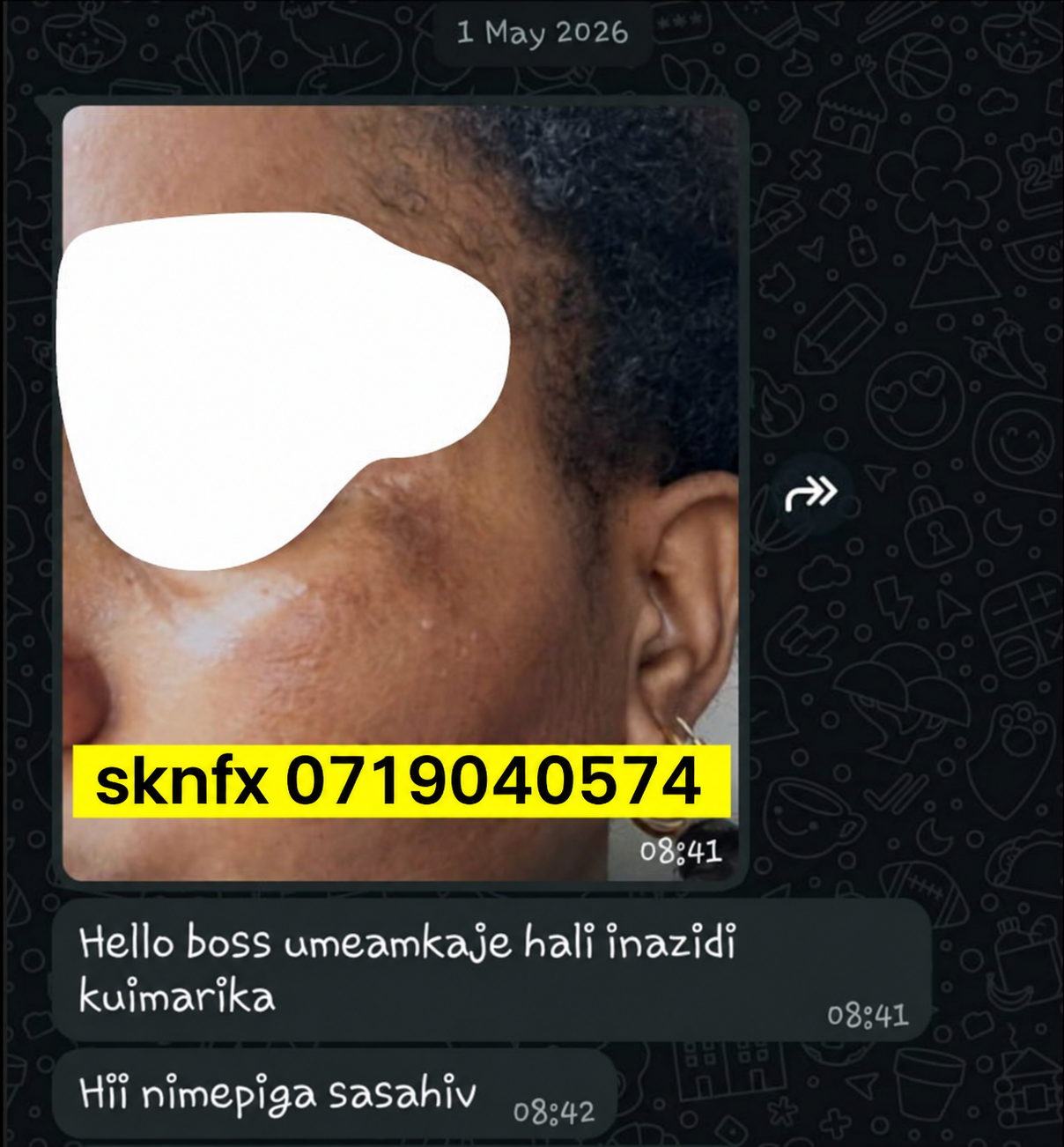 Sehemu ya tisa ya story ya mteja wa SKNFX