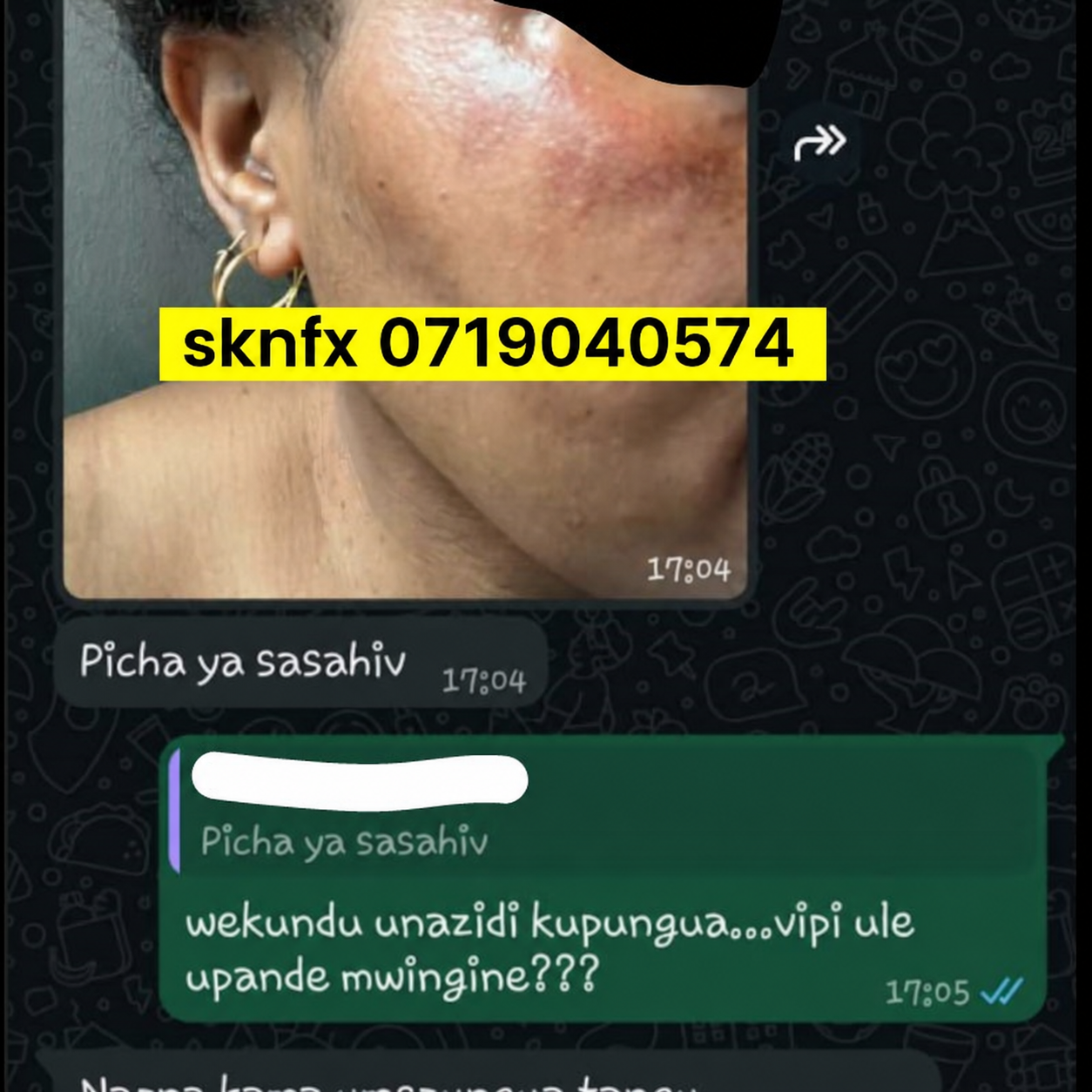 Sehemu ya sita ya story ya mteja wa SKNFX